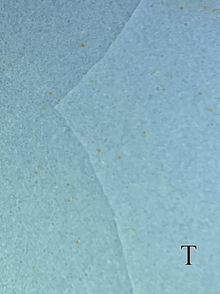 bottom